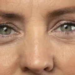 Primer plano de unos ojos verdes con líneas de expresión marcadas alrededor.