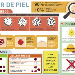El cáncer de piel, incluyendo el melanoma, se previene con protección solar. Aprende sus síntomas y factores de riesgo.