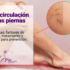 Piernas con mala circulación, mostrando arañas vasculares. Texto: "Mala circulación en las piernas. Síntomas, factores de riesgo, tratamiento y consejos para prevención.