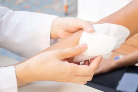 Manos curando una herida infectada con pus. Aprende cómo curar una herida infectada con pus para una pronta recuperación.