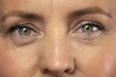 Primer plano de unos ojos verdes con líneas de expresión marcadas alrededor.
