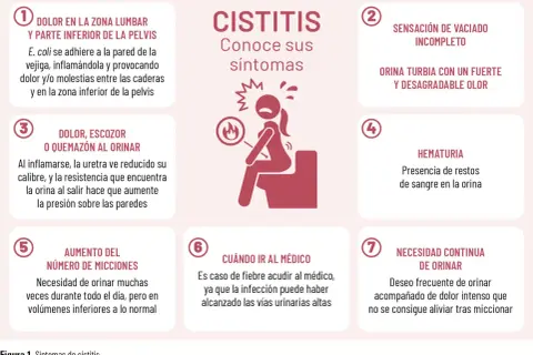 La cistitis, aunque no es contagiosa, causa dolor lumbar, ardor al orinar, orina turbia y necesidad constante de miccionar.