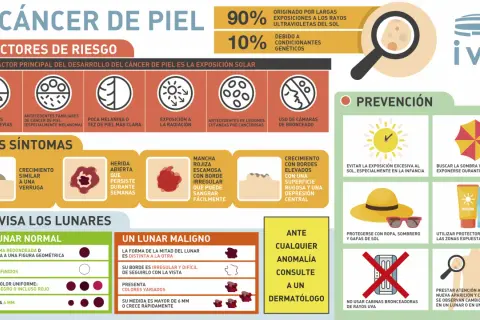 El cáncer de piel, incluyendo el melanoma, se previene con protección solar. Aprende sus síntomas y factores de riesgo.