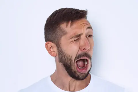 Hombre con barba y tics nerviosos musculares, guiñando un ojo y con la boca abierta en un gesto de sorpresa o grito.