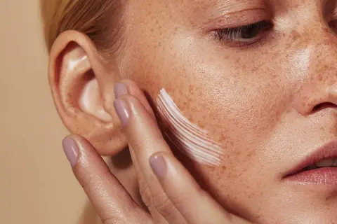 Una mano aplica crema en la mejilla de una mujer con pecas. La crema, que ayuda a controlar el sebo, deja un rastro blanco.