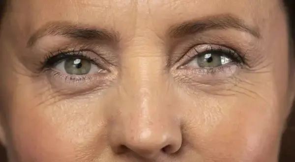 Primer plano de unos ojos verdes con líneas de expresión marcadas alrededor.