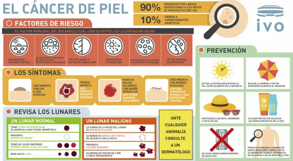 El cáncer de piel, incluyendo el melanoma, se previene con protección solar. Aprende sus síntomas y factores de riesgo.