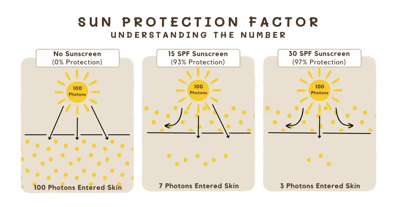 Ilustraci&oacute;n compara diferentes tipos de filtros solares: sin protecci&oacute;n, SPF 15 y SPF 30, mostrando c&oacute;mo bloquean los fotones del sol.