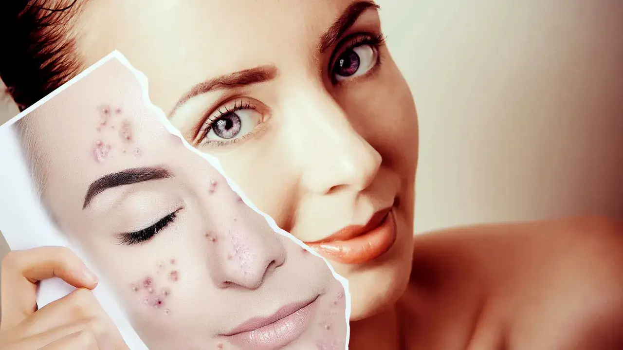 Mujer sonr&iacute;e mientras sostiene una foto de su rostro con granitos.