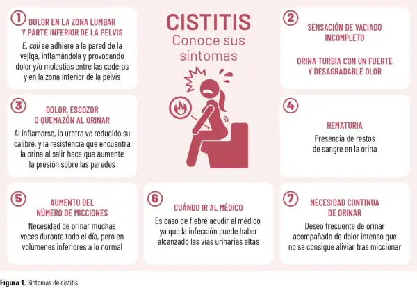 La cistitis, aunque no es contagiosa, causa dolor lumbar, ardor al orinar, orina turbia y necesidad constante de miccionar.